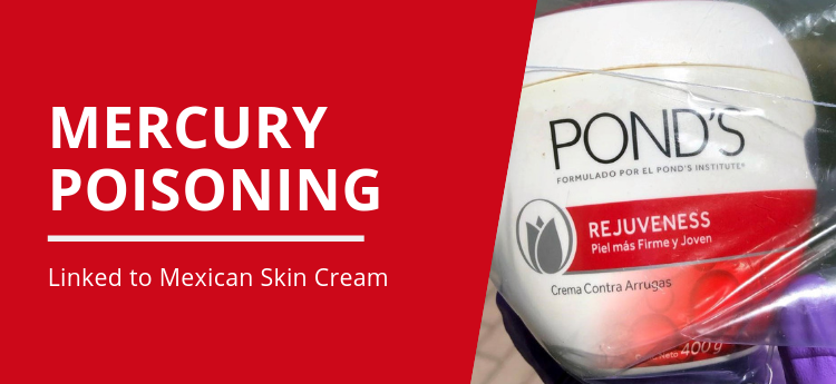 Mercury poisoning linked to Mexican skin cream with image of Ponds skin cream